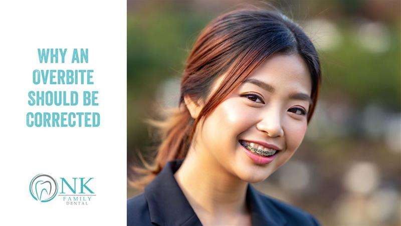 nk family dental may 2025 blog post 1 overbite