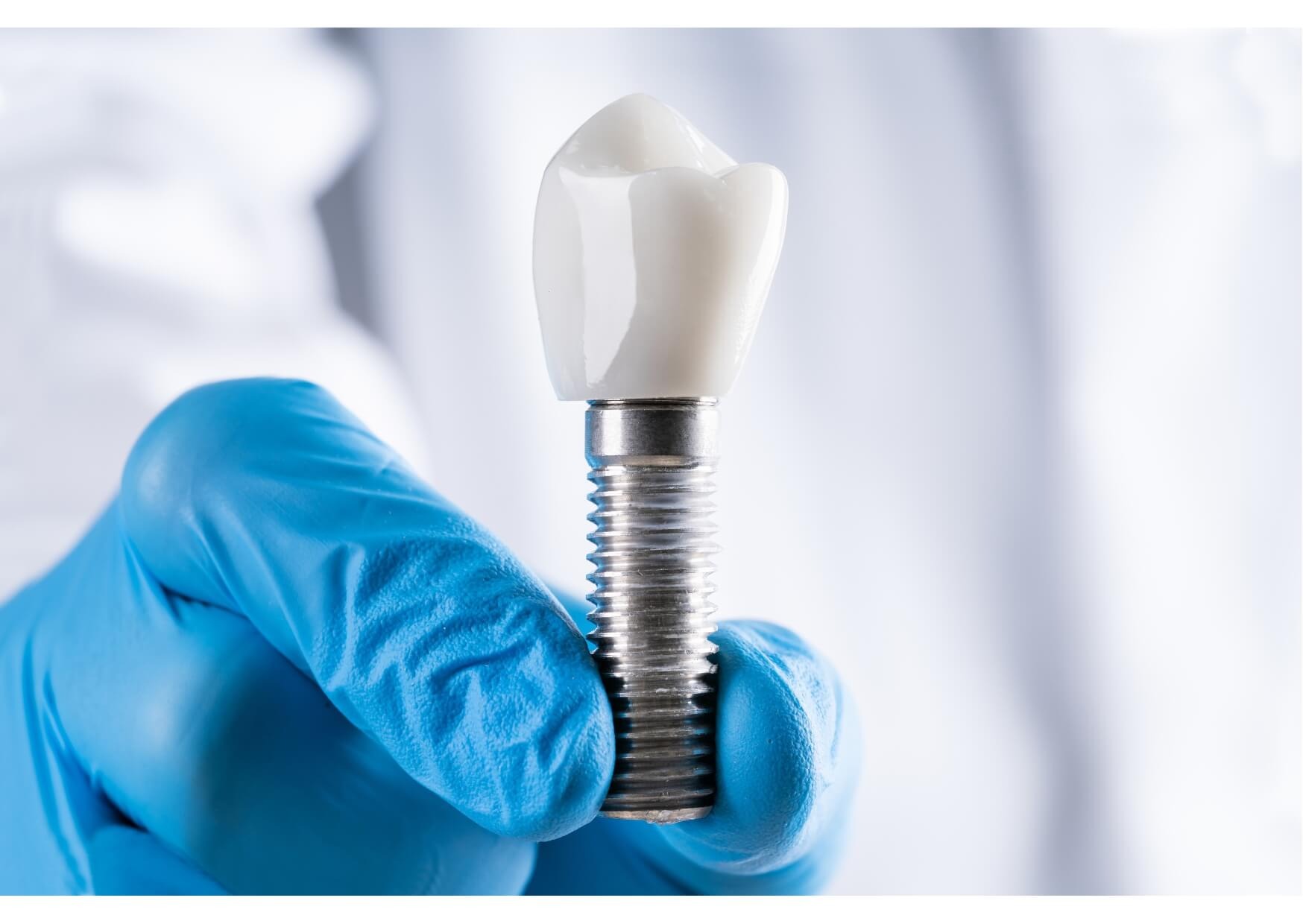 Close-up of a dental implant crown used to explain the cost of dental implants and tooth replacement options