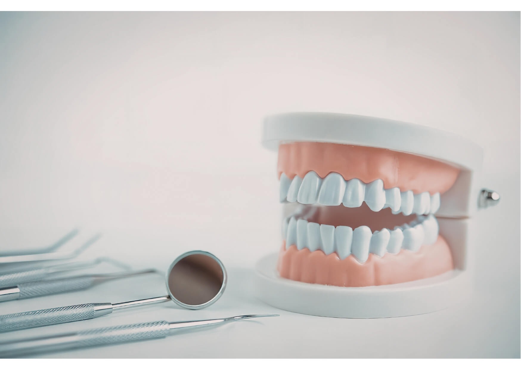 Dental model with cosmetic restorations and dental tools used to compare bonding vs veneers treatments