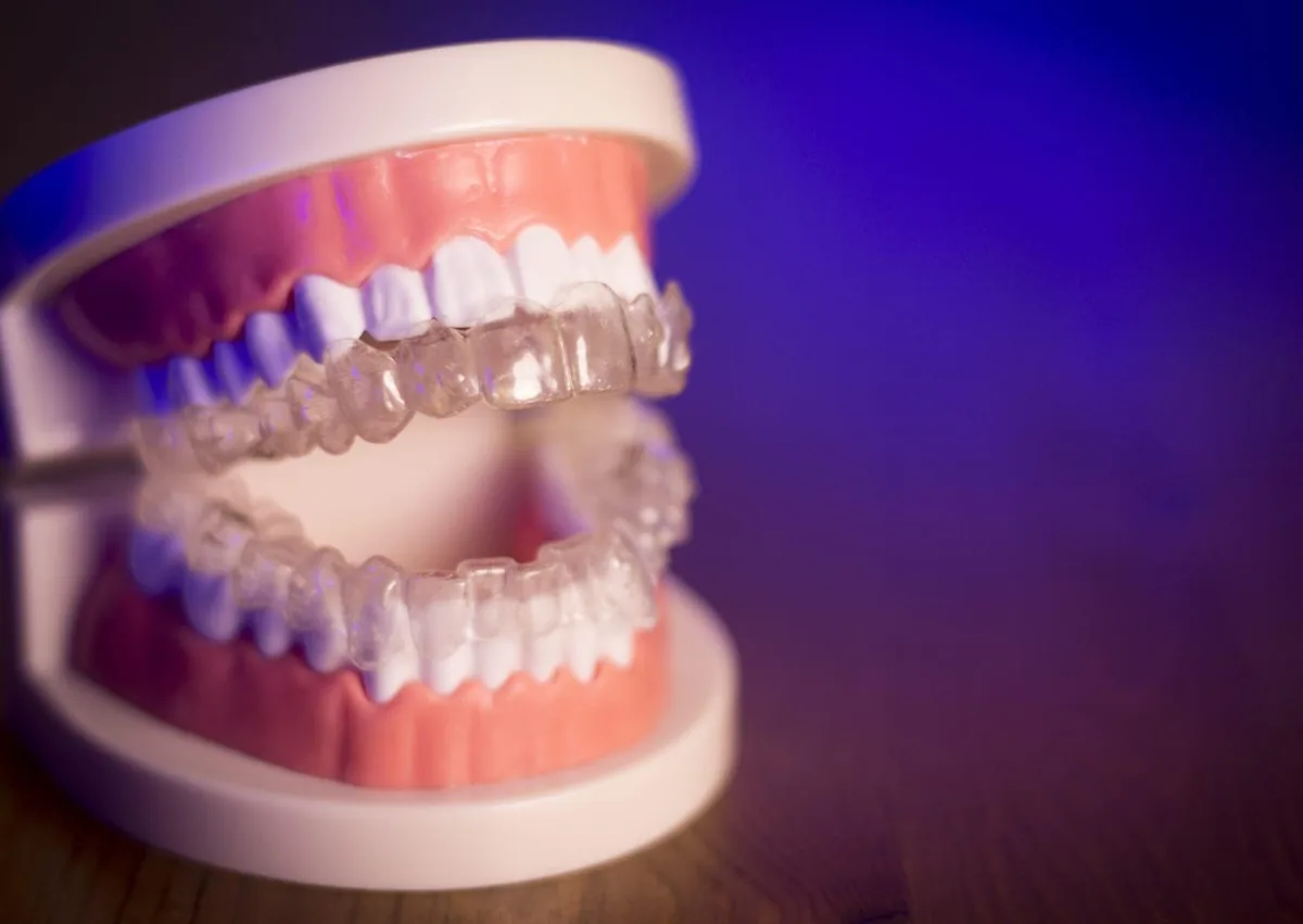 Dental model with clear aligners representing orthodontic treatment options and braces costs with insurance.
